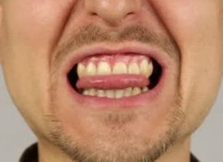 Biting Tongue In Sleep – Causes and Treatment