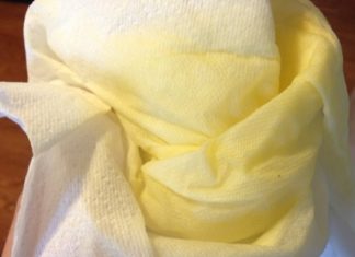 Yellow Discharge Before and After Period and During Pregnancy