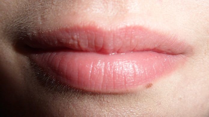 Small White Bumps on Lips - Causes and Treatment