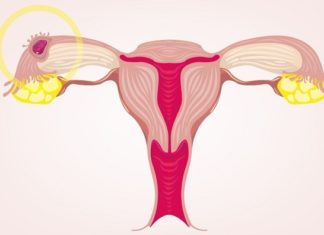 How Long Does Implantation Bleeding Last and Can It Be Heavy?