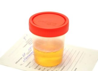 Mucus Threads in Urine – Causes and Treatment