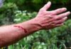 Dreams About Being Shot, Getting Shot – Interpretation and Meaning
